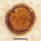 La diferencia en los tipos de células es visible al microscopio.